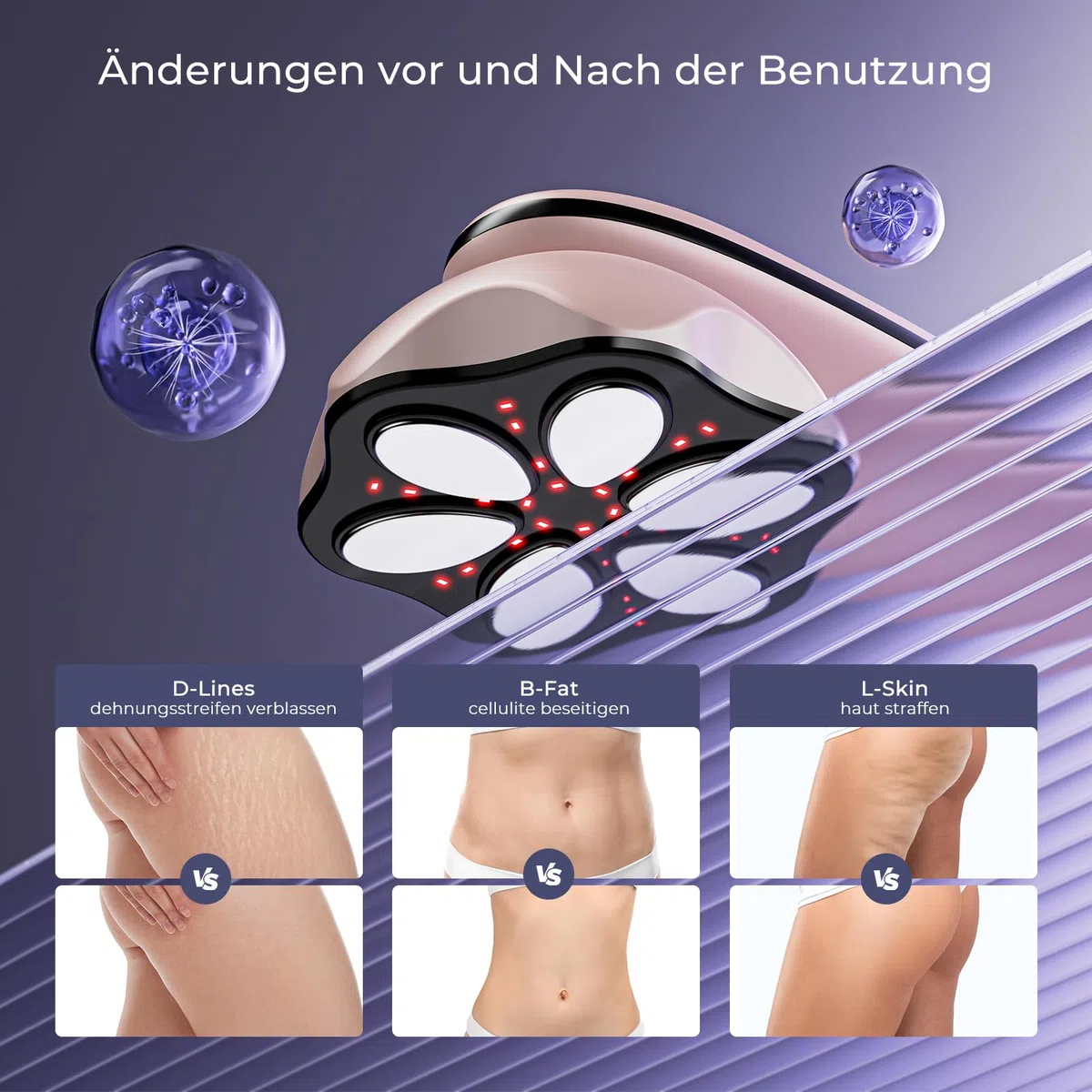 Cellulite Massagegerät Anti Lipödem Handmassagegerät, Nachgewiesene Wirksamkeit, mit 6 MassageköPfen, Geeignet für Bauch, Taille, Arme, Beine, Gesäß (Roségold)