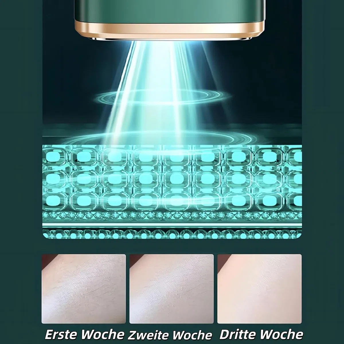 IPL Geräte Haarentfernung Laser mit Gefrierfunktion, Schmerzfreie Haarentfernungsgerät,Geräte Haarentfernung mit Saphir-Eis, Lichtimpulse und Energiestufen für Körper, Gesicht, Bikini (Dunkelgrün)