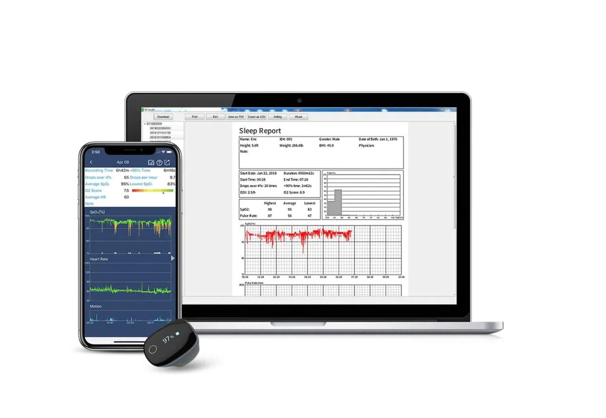 O2 Ring Pulsoximeter – SpO2-Schlafmonitor in Ringform mit Vibrationsalarm, kontinuierlicher Nachtaufzeichnung, App-Auswertung für iOS/Android, komfortabler Sauerstoff- & Pulsmesser