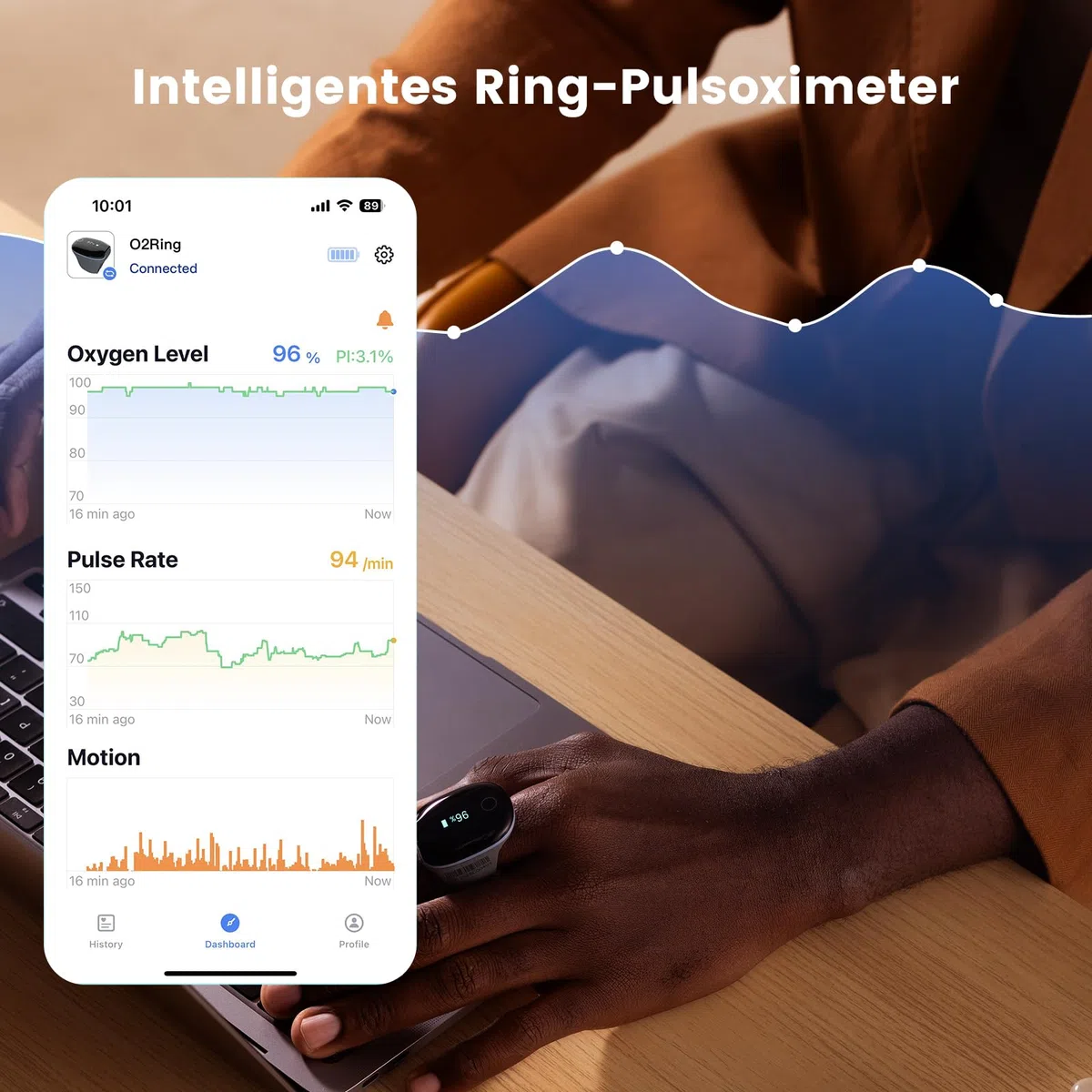 Wellue O2 Ring Bluetooth Pulsoximeter mit alarm, Sauerstoffsättigung Messgerät mit kontinuierliche Überwachung, Schlafoximeter für Blutsauerstoff und Herzfrequenz, Professional APP und Berichte